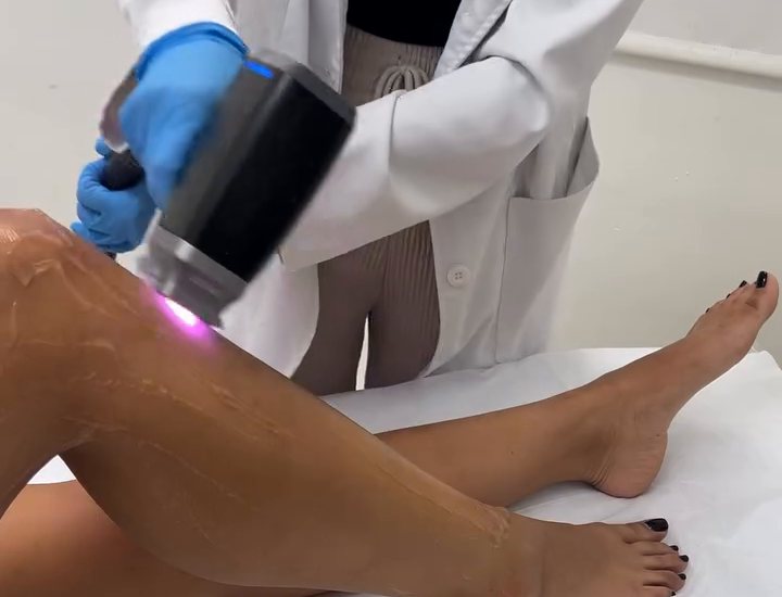 A gloved hand passing the diode laser handpiece over a leg during a session